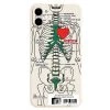 Boogzel Apparel Skeleton Heart IPhone Case IPHONE CASES